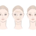 Easy 6 step-makeup to hide nasolabial fold!